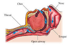 Airway Management and ACLS
