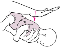 Infant Choking Tips